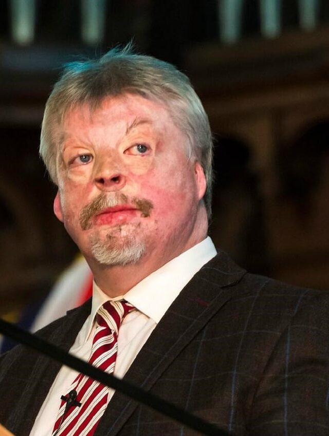 Simon Weston