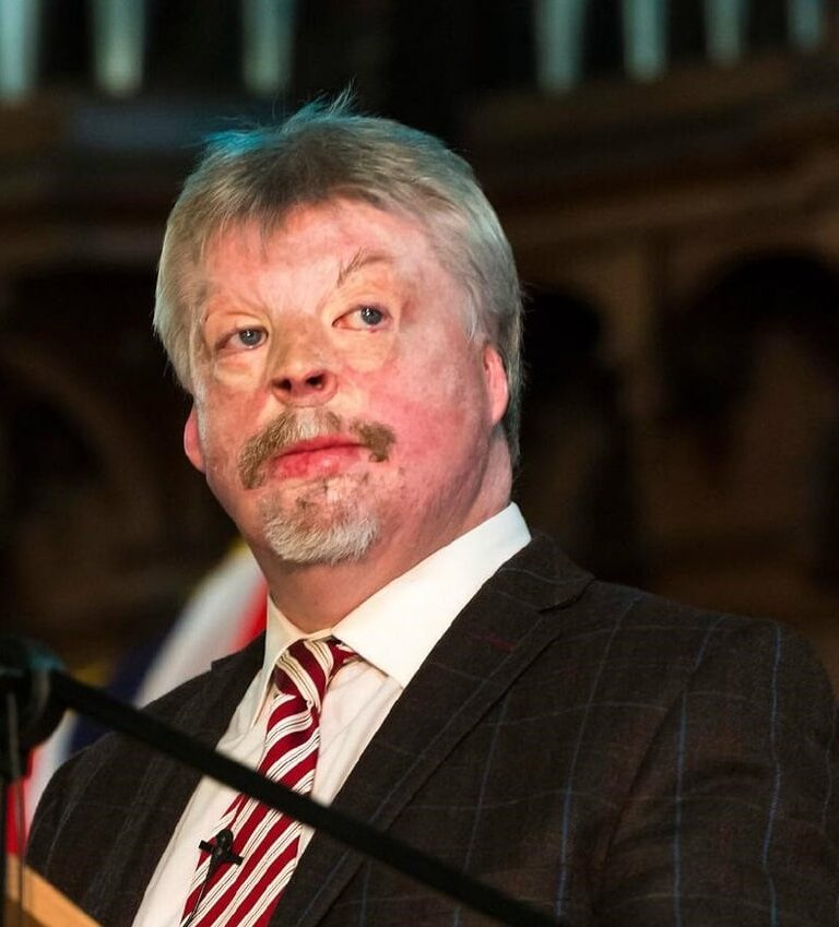 Simon Weston